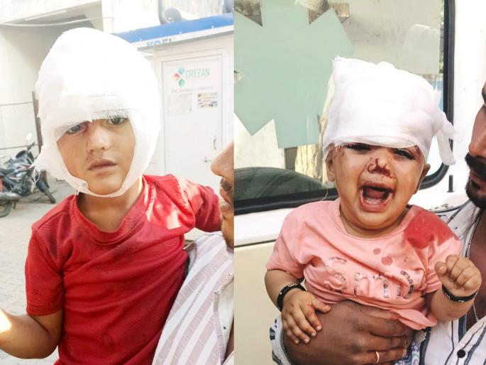 Three children seriously injured in the clutches of stray dogs in Parbhani district Parents angry